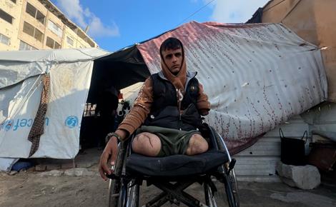 رائد معروف بين بتر الأطراف والنزوح في غزة